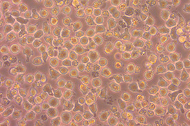 吉田肉腫（YS-TC 細胞 TKG 0654）